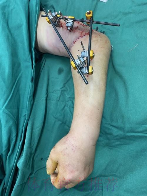 克林根击地助攻 西索科切入双手挂扣 克林根击地助攻 西索科切入双手挂扣